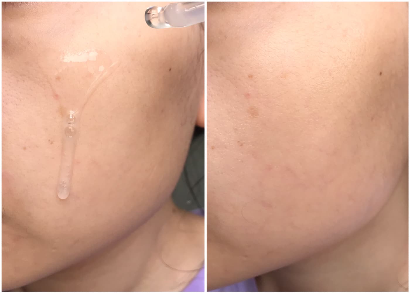 Cam nhan khi su dung 9Wishes Hydra Skin Ampule Serum